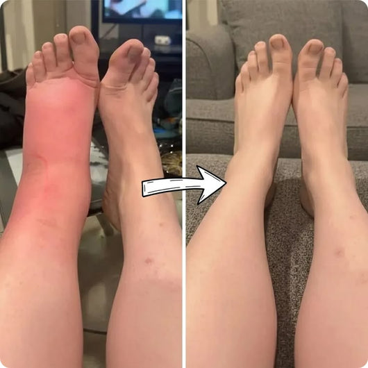 ALLEVA® — Le Rituel Jambes Légères