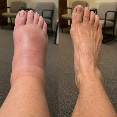 ALLEVA® — Le Rituel Jambes Légères