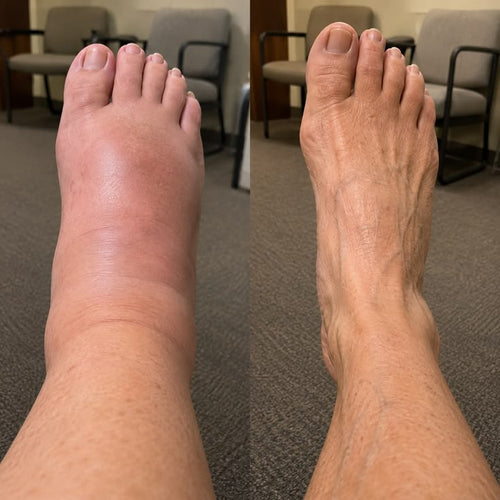 ALLEVA® — Le Rituel Jambes Légères